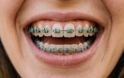 Jak to możliwe, że zęby „przesuwają się” w twardej kości? Poznaj magię (a raczej fizjologię!) ortodoncji!